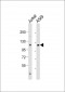NIK Antibody (Center)